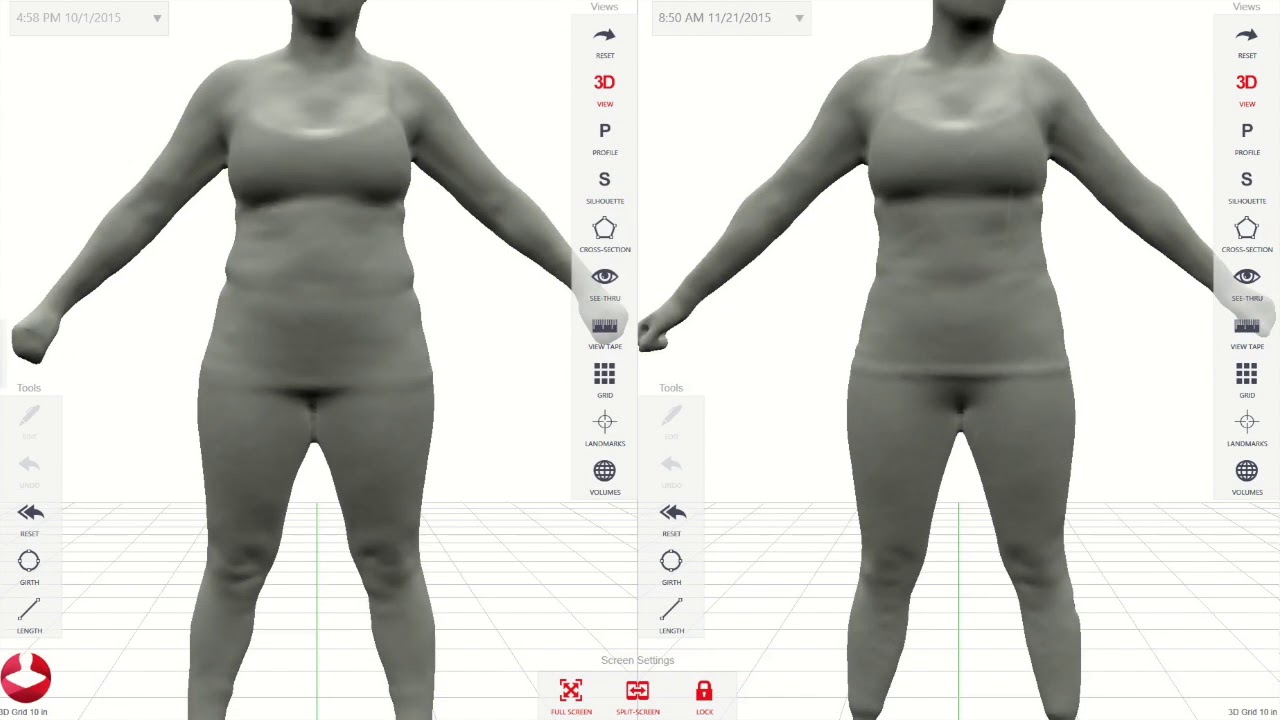 BODY COMPOSITION SCAN